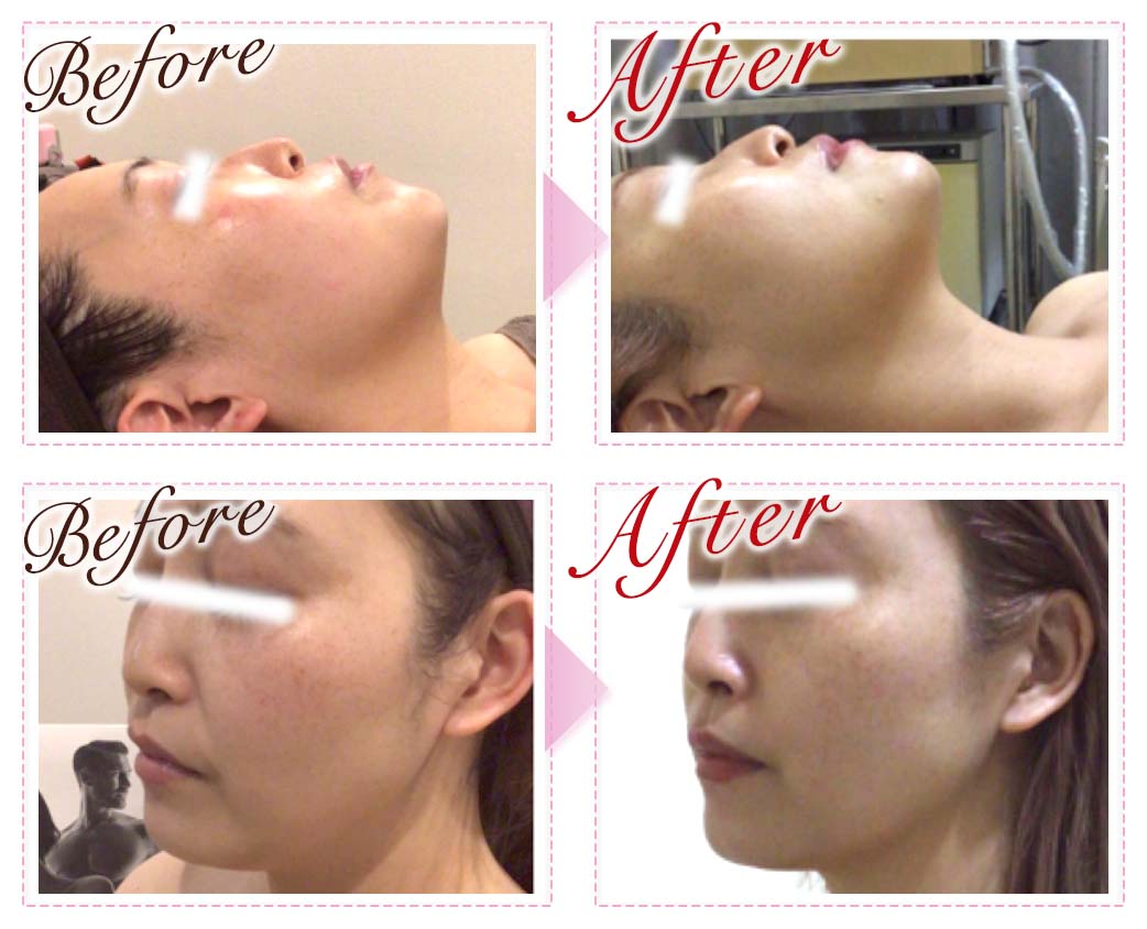 ビフォーアフター